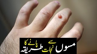 Mason & Mohkon (Warts) Ka Ilaj | Tibe Ahlebait (Part 30) | مسے | Maulana Syed Ali Naqi Kazmi screenshot 4