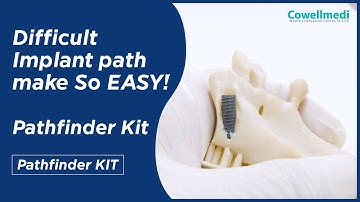 Difficult Implant path make So EASY! Wonderful Pathfinder Kit!