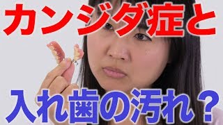 カンジダ症と入れ歯の汚れは関係ない？　口腔ケアチャンネル　1197（口腔ケアチャンネル2　＃869）