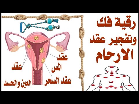 ساحر الرحم إبطال سحر الأرحام دك و تدمير حصون و عقد المبايض الراقي المغربي أبو رشيد
