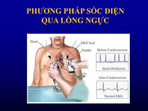 Video: Cách Tạo Nhịp