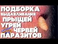 КАРАВАЙTV / ПОДБОРКА ВЫДАВЛИВАНИЯ ПРЫЩЕЙ / УГРЕЙ / ПАРАЗИТОВ / ЧЕРВЕЙ