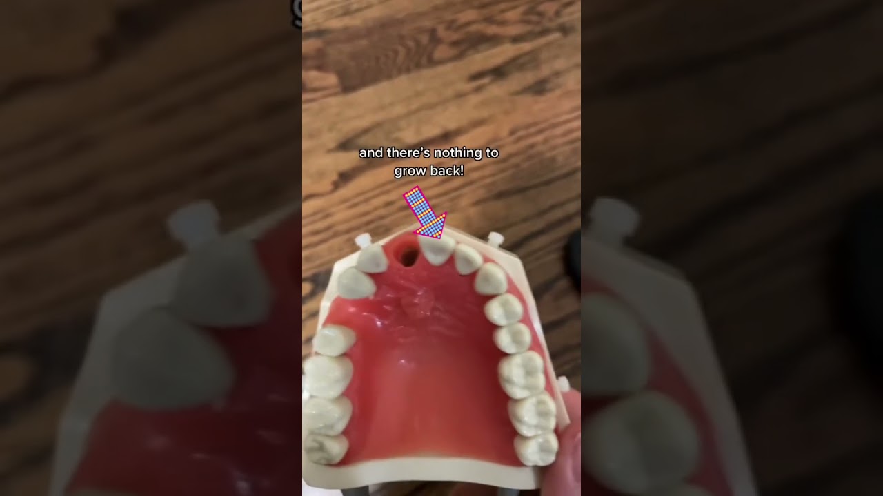 Here’s what happens when your tooth falls out! 