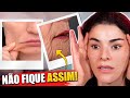 Melhore o rosto cado rugas na boca e contorno facial com resultado imediato e permanente