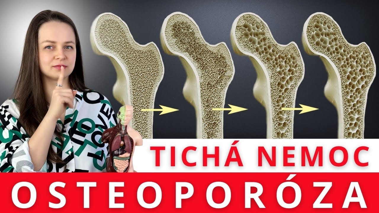 Skutečné PŘÍČINY OSTEOPORÓZY / Posilte své kosti doplňkami stravy / Je možné ji vyléčit?