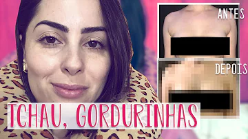 Quanto custa uma lipoaspiração na axila?