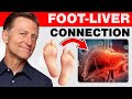 How Your Feet Are Warning You About Your Liver Problems - Dr. Berg Explains