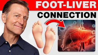 How Your Feet Are Warning You About Your Liver Problems  Dr. Berg Explains