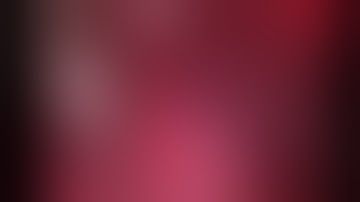 LaparoscopicTEP Repair of Rt inguinal hernia using Parietex anatomical mesh