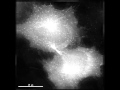 Cytokinesis in hela eb1gfp