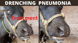 Drenching Pneumonia Treatmentpleural Effusiondysneawater On Lungs