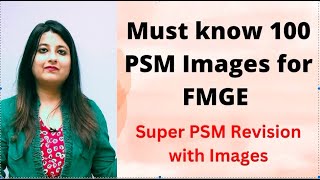 Must know 100 PSM Images for FMGE/ Supersonic PSM Revision#fmge2022 #next #neetpg2023