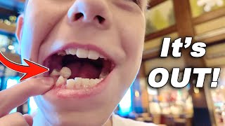 Don't Swallow That HUGE Tooth!