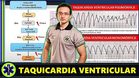 Como controlar a taquicardia ventricular?
