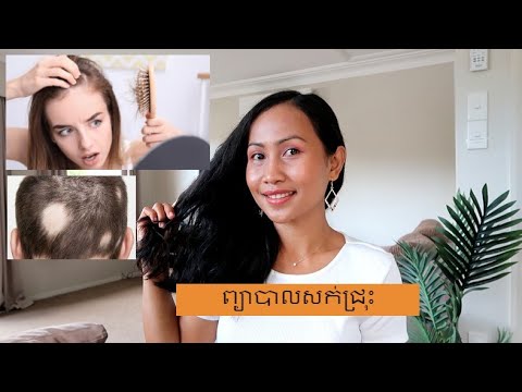 ព្យាបាលសក់ជ្រុះ (Stop hair loss)