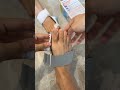 How to Correct Toe Deformity at Home ( # 2115 ) ▶️ Adjustable Foot Care Big Toe Straightener