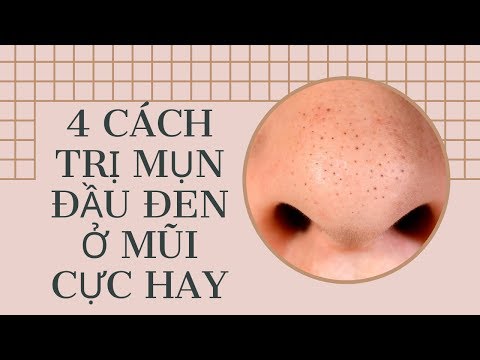 Hé lộ 4 cách “TRỊ MỤN ĐẦU ĐEN” ở mũi cực hay | BÍ KÍP LÀM ĐẸP