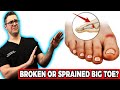 Broken Big Toe or Sprained Big Toe Joint? [BEST Home Treatment 2021]