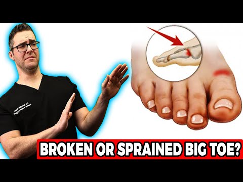 Video: Sprained Toe: Symptomer, årsaker, Behandling, Restitusjonstid Og Mor