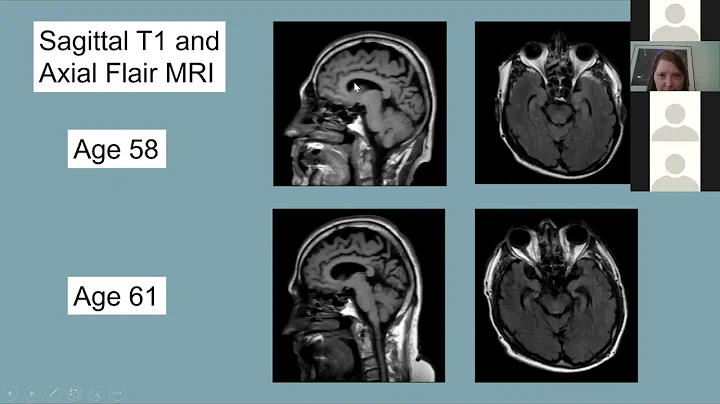 Clinical Pathological Correlation Conference   February 12, 2021