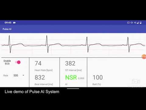 ECME Mini Projects: Pulse AI Project Update