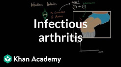 Infectious arthritis | Muscular-skeletal diseases | NCLEX-RN | Khan Academy