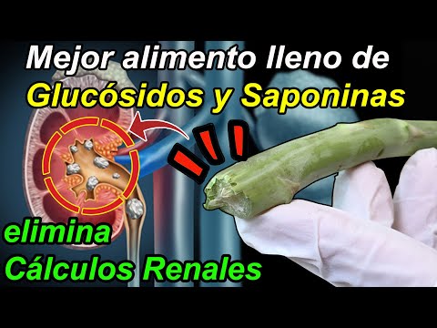 <strong>Con</strong> <strong>ESTO</strong>! Tus Riñones Quedarán como Nuevos eliminando Cálculos Urinarios y Renales