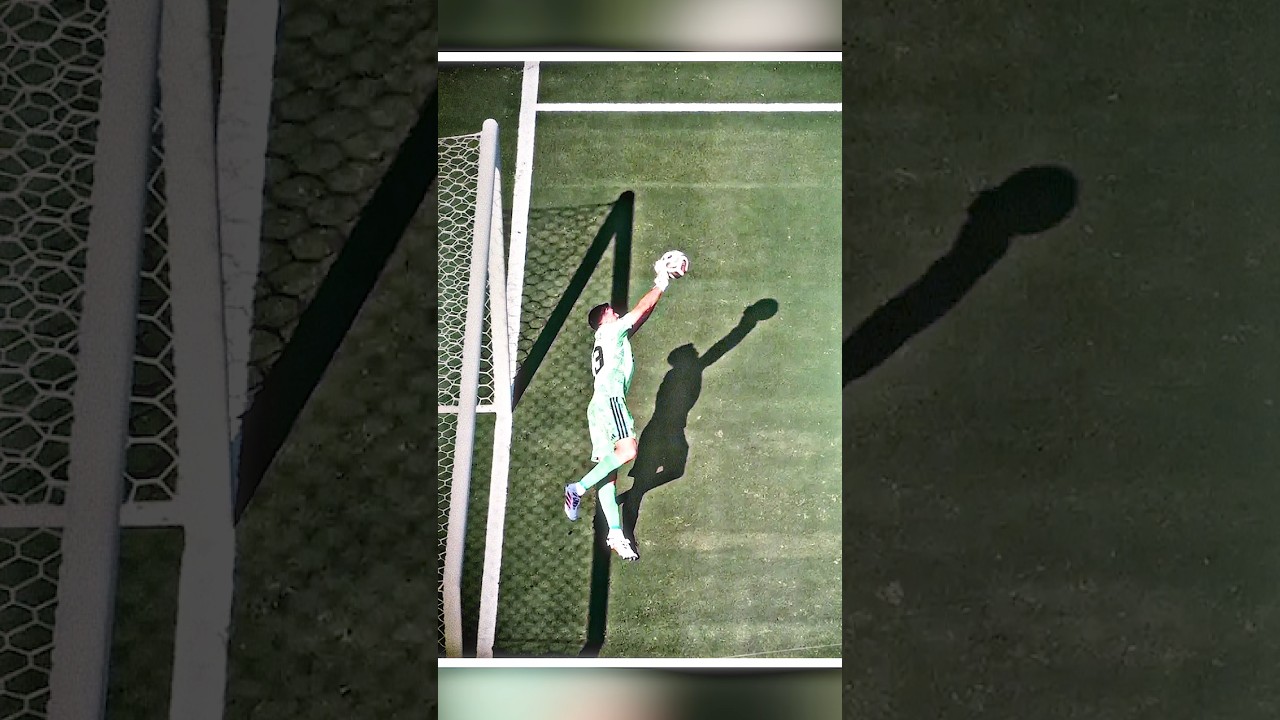 He Played the World Cup Final With a Broken Finger 😳🧤