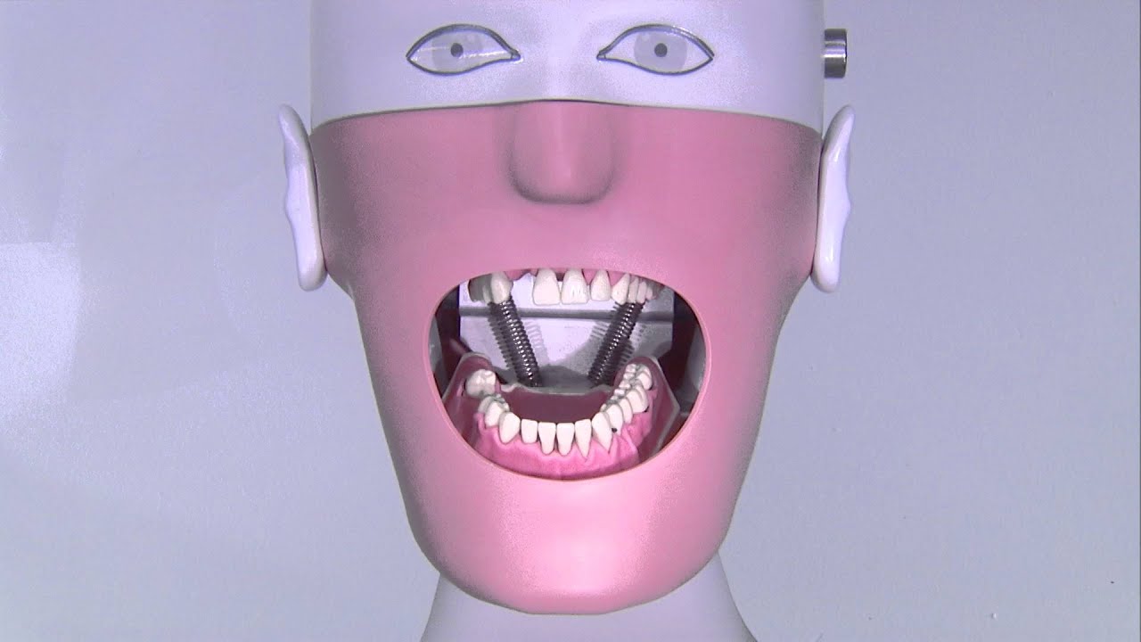 alginate impression records ndt alginate impression records ndt