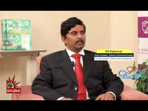 FAQ's about Vascular Surgery | Dr. Rajkumar | Dr. Kamakshi memorial ...