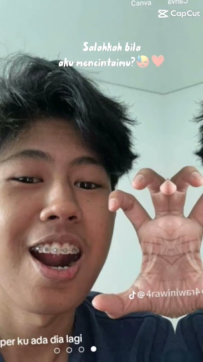 versi evos abaxx dan evos nune