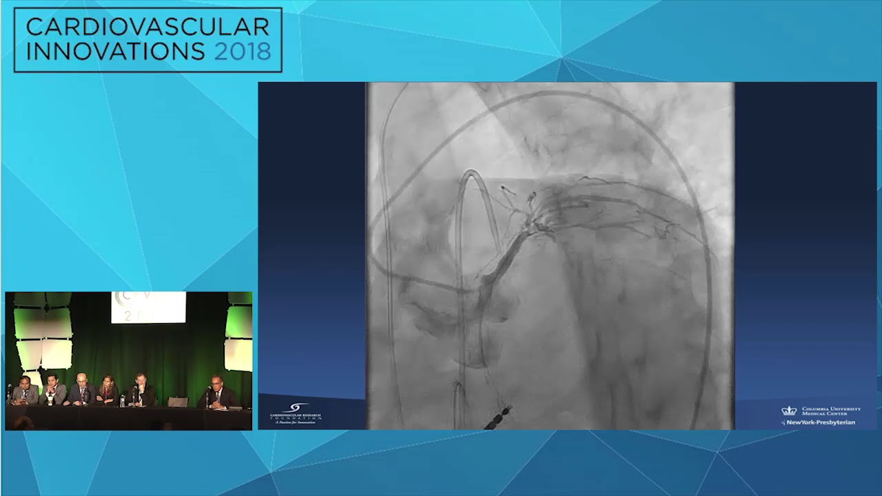 CVI2018 Session: My Best Case of the Year - Manish Parikh, MD interventional cardiology jobs