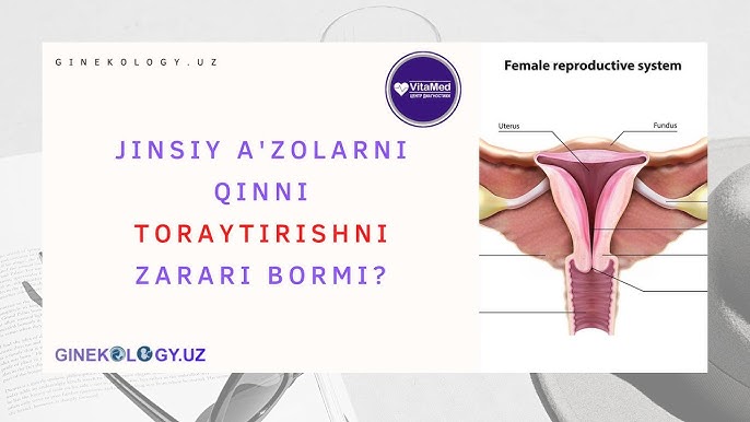 Ivanovo bosh vaqtlarida transseksuallar