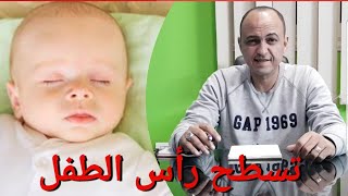 الحل السريع للتخلص من تسطح رأس الطفل الرضيع - دكتور حاتم فاروق