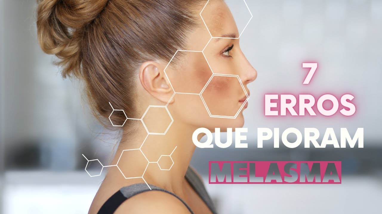 7 ERROS QUE PIORAM O MELASMA NO ROSTO - YouTube