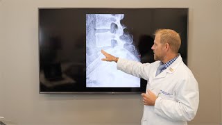 Understanding Degenerative Disc Disease Through A Patient’s Journey | Causes, Symptoms, & Treatments