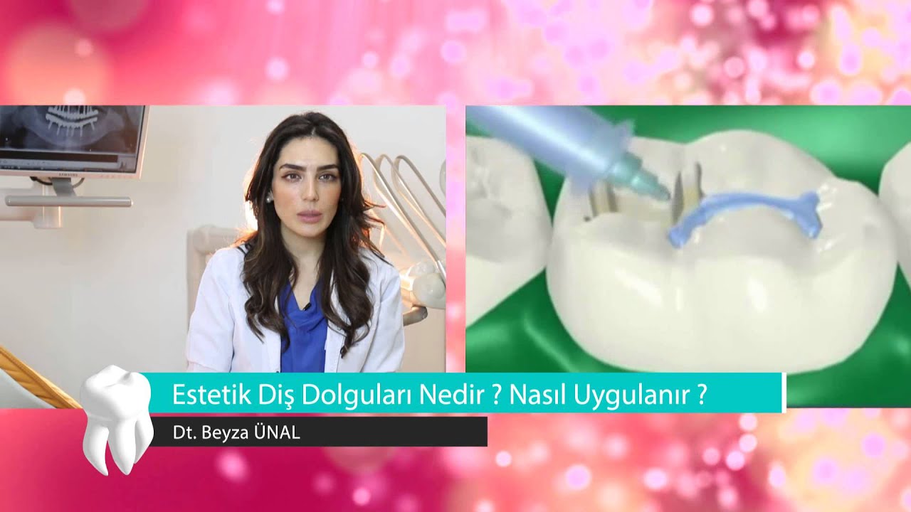 Estetik Dolgu Nedir Estetik Dolgu Nasıl Yapılır Estetik Dolgu Nedir Estetik Dolgu Nasıl Yapılır