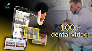 Dental videos and animations for dentists|patient education|DentiCalc screenshot 3