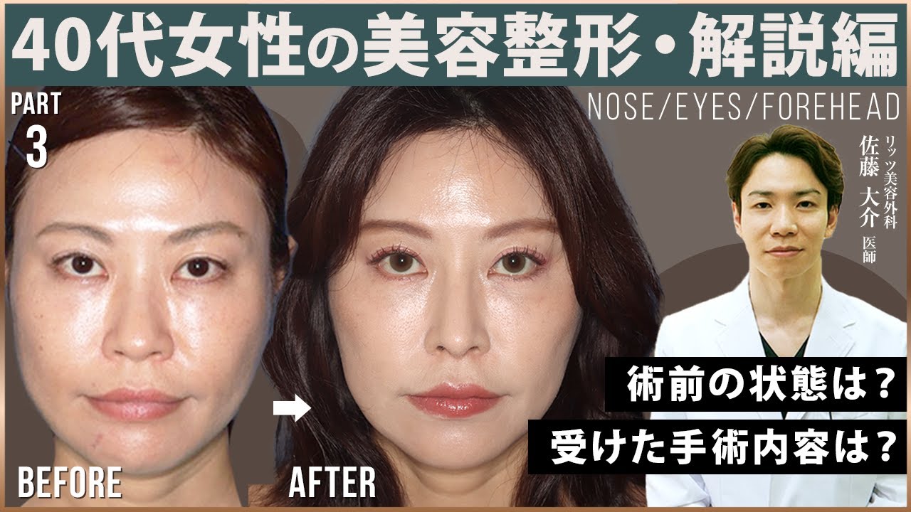 美容手術の基本 佐藤大介著 maxresdefault.jpg