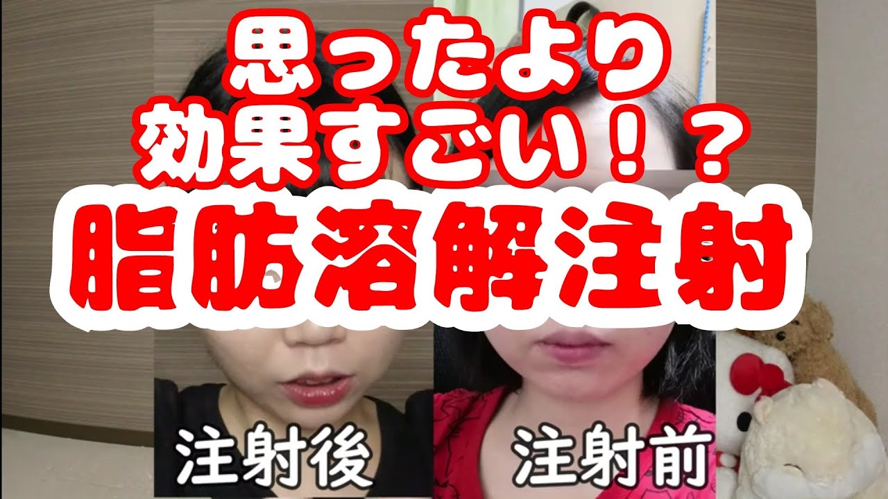 【ダイエット】脂肪溶解注射ってホントに効くの？比較編