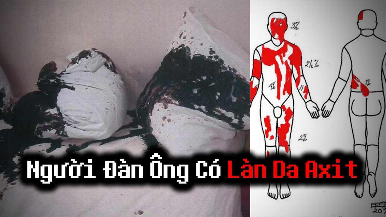 Người Đàn Ông Với LÀN DA AXIT