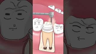 根管治疗root canal therapy