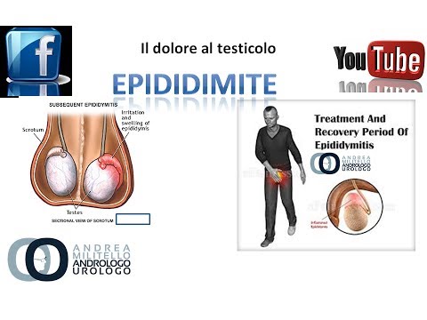 Video: Epididimite Cronica: Sintomi, Trattamento, Cause