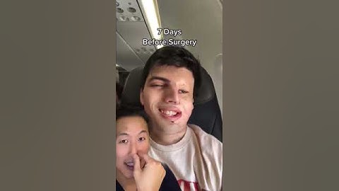 Countdown to Nasal Reconstruction Surgery! #shorts #nasalreconstruction