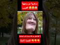 سخروا من وجهها الغريب ولكن بعد 10 سنوات كانت المفاجأة سخروا من وجهها الغريب ولكن بعد 10 سنوات كانت المفاجأة