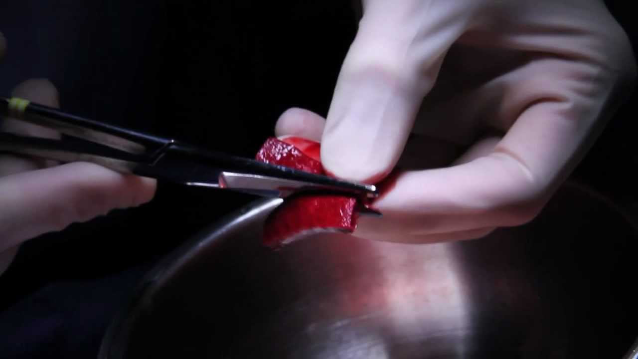 Bone Graft Substitutes for Spine Surgery spine journal impact factor