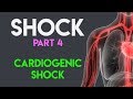 Cardiogenic Shock Shock Part 4 