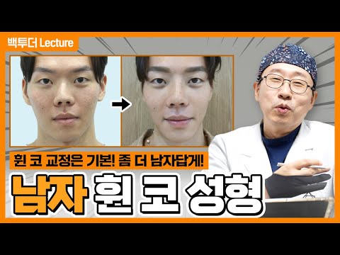 [남자 코성형] 휜코 제대로 폈더니, 코끝에서 훈내 진동!!
