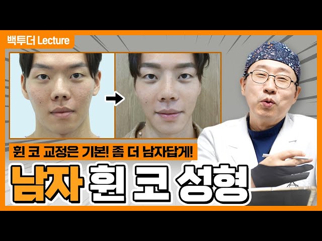 [남자 코성형] 휜코 제대로 폈더니, 코끝에서 훈내 진동!!