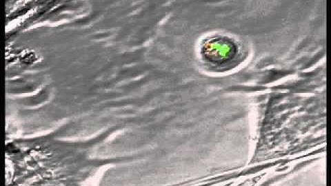 ACBD Videomicroscopy of histone H2B-GFP HSC